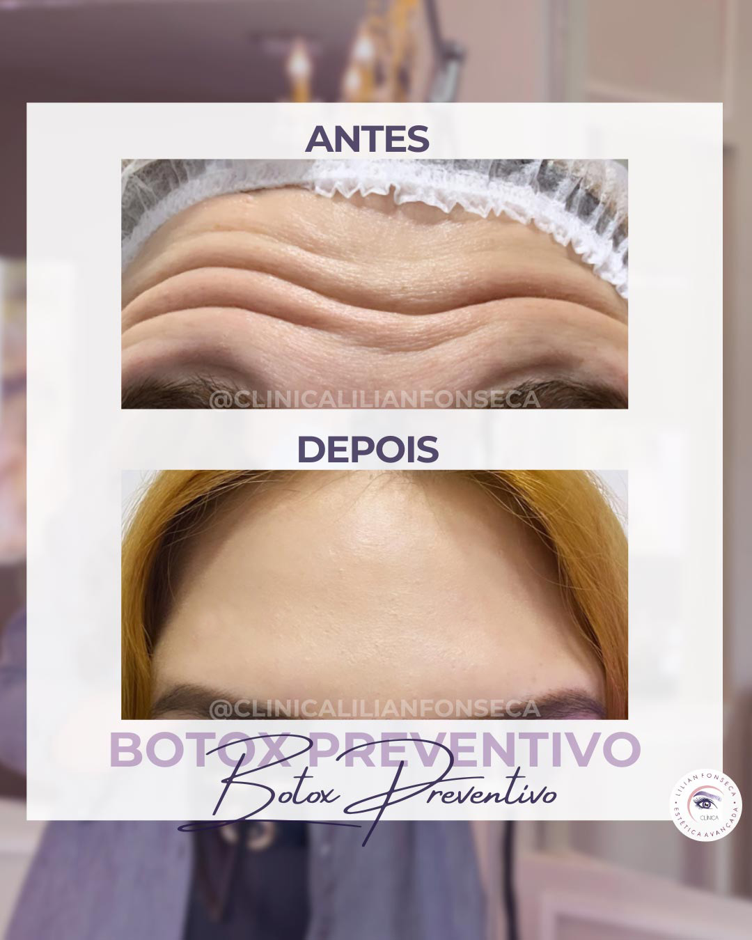 Resultado de tratamento 1