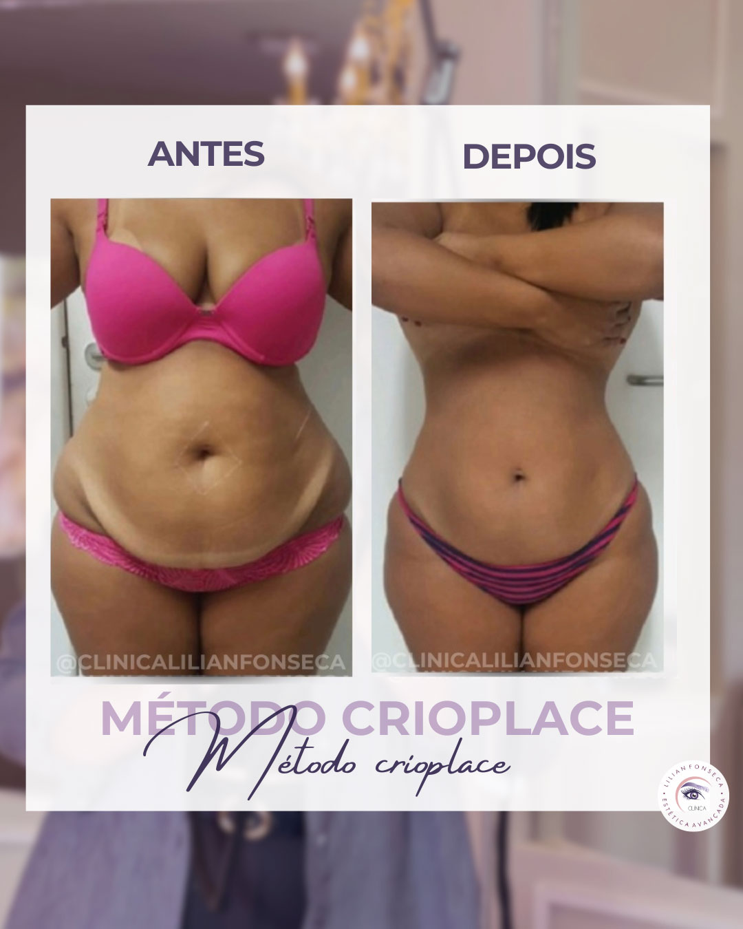 Resultado de tratamento 1