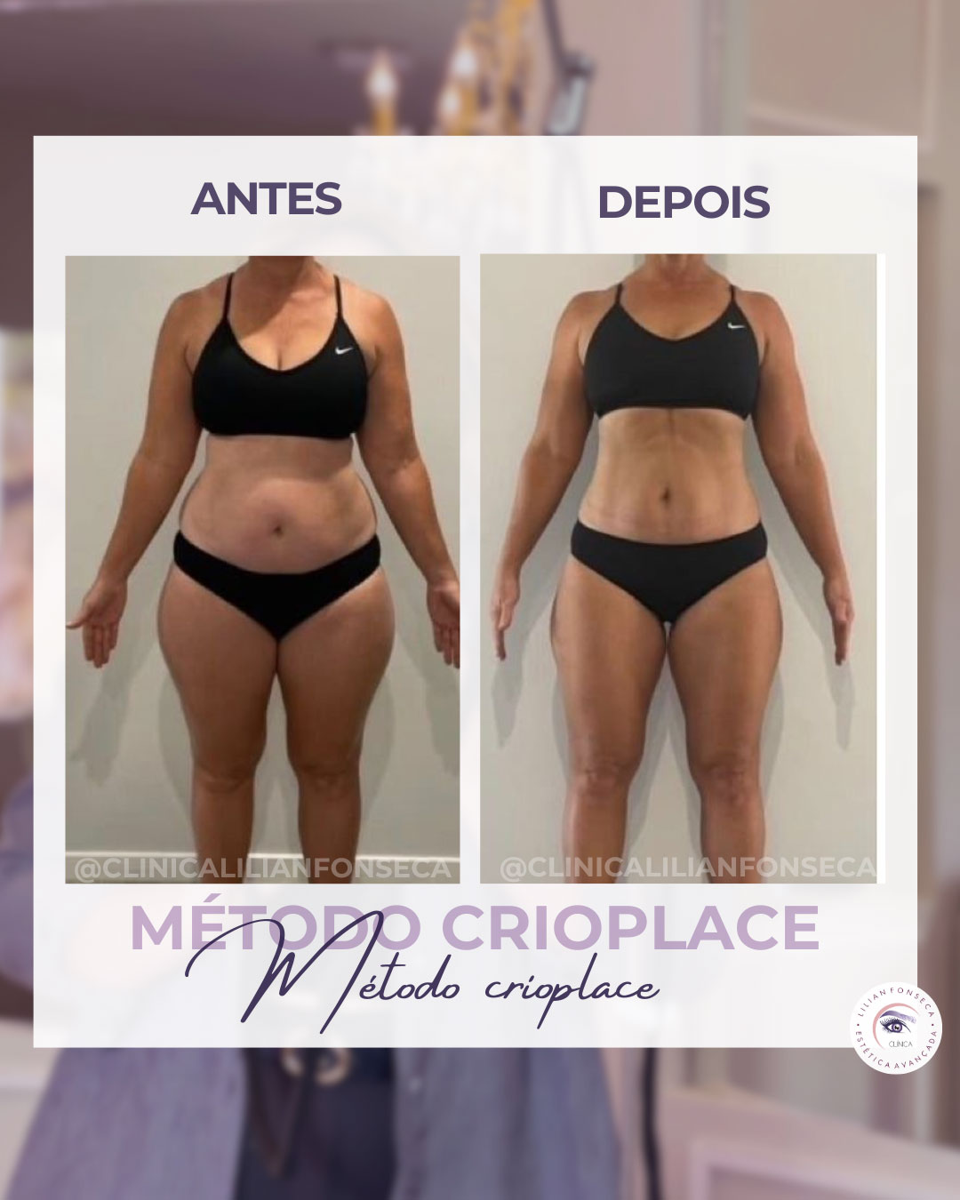 Resultado de tratamento 2