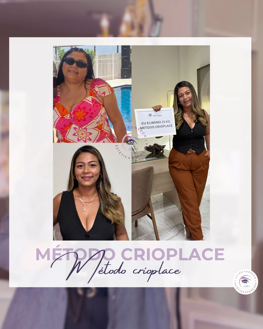 Resultado de tratamento 5