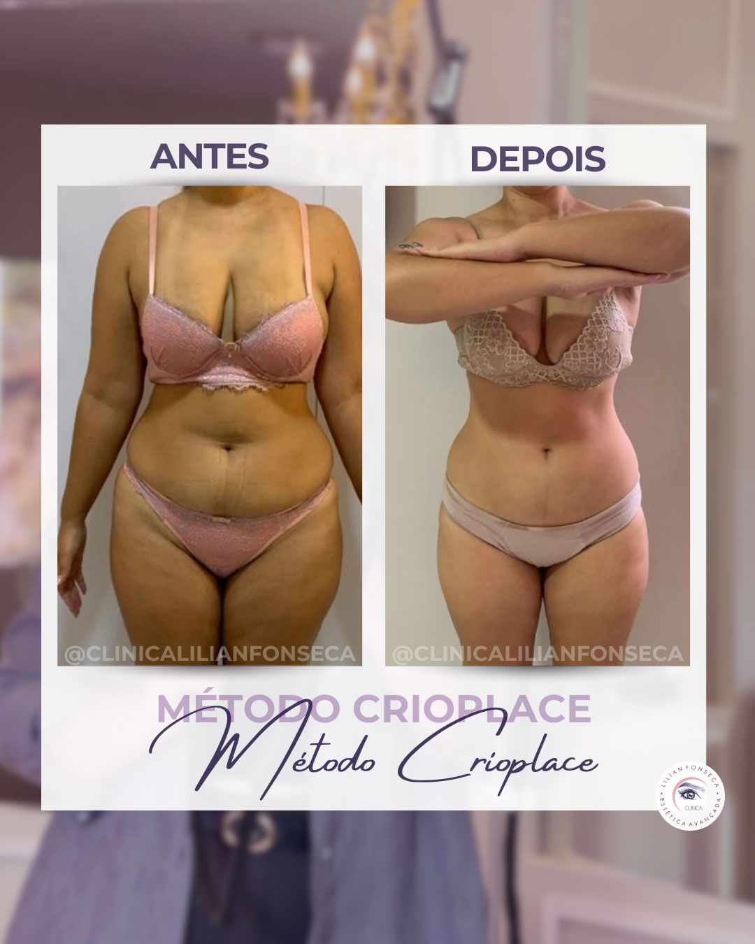 Resultado de tratamento 6