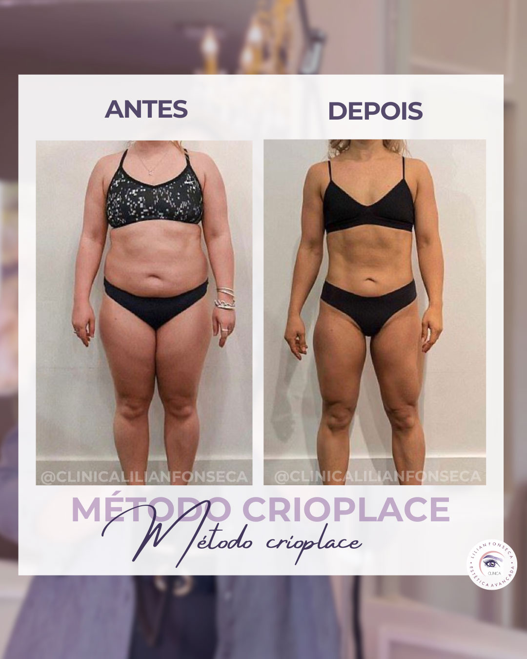 Resultado de tratamento 7