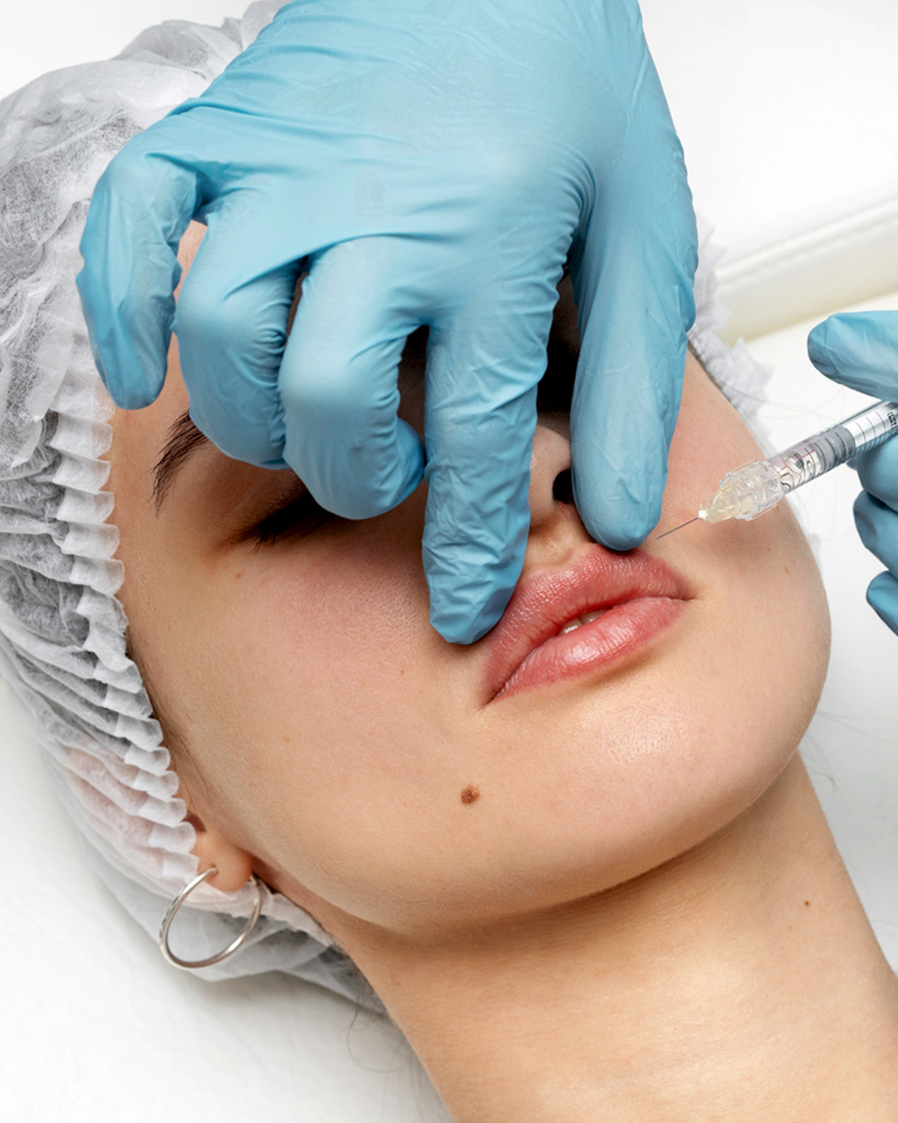 Preenchimento Labial na Clínica Lilian Fonseca