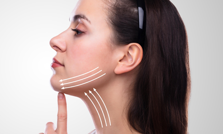 Procedimento de Lipo de Papada para eliminar queixo duplo.