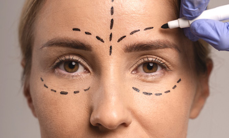 Procedimento de Preenchimento de Olheiras.