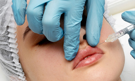 Procedimento de Preenchimento Labial.